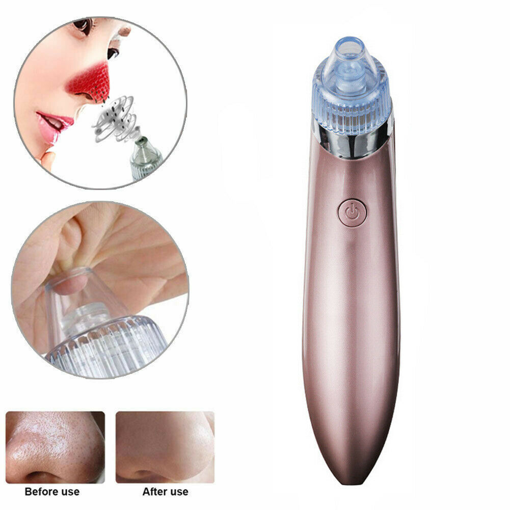 Electric Blackhead Vacuum Pore Cleaner with Strong Suction for Acne Removal
