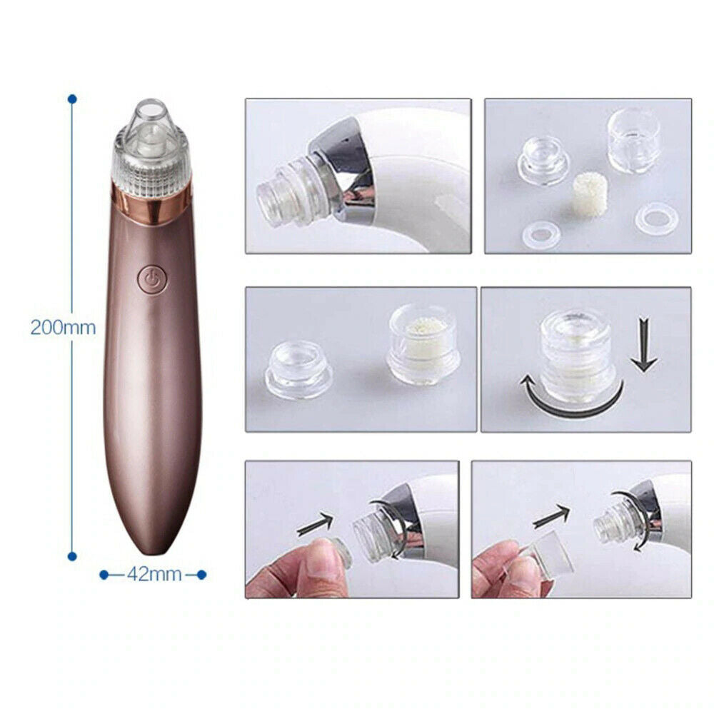 Electric Blackhead Vacuum Pore Cleaner with Strong Suction for Acne Removal