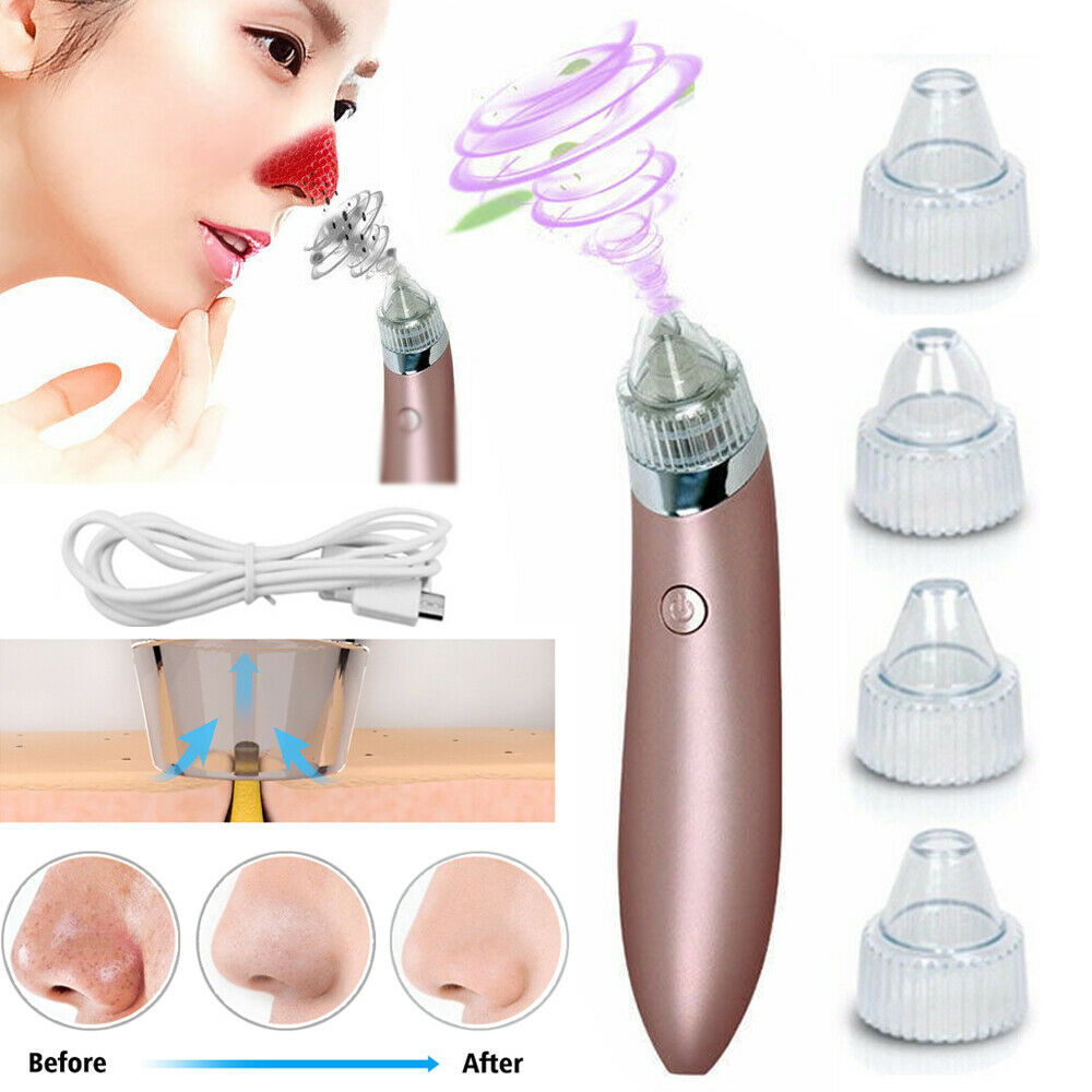 Electric Blackhead Vacuum Pore Cleaner with Strong Suction for Acne Removal